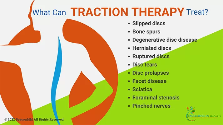 Chiropractic Anchorage AK Traction Therapy
